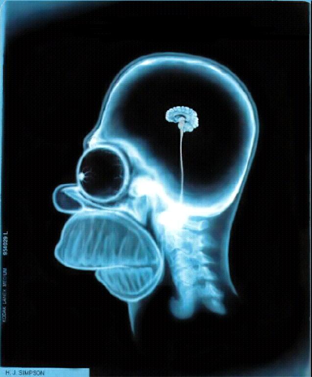 petit_cerveau.jpg (55327 octets)